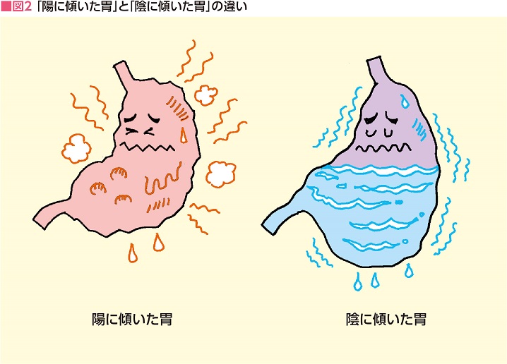 「陽に傾いた胃」と「陰に傾いた胃」の違い